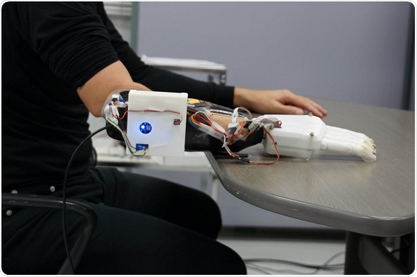 Scientists develop new 3D-printed prosthetic hand that can learn wearers’ basic motions