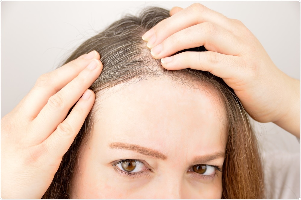 Woman examining hair loss on head.