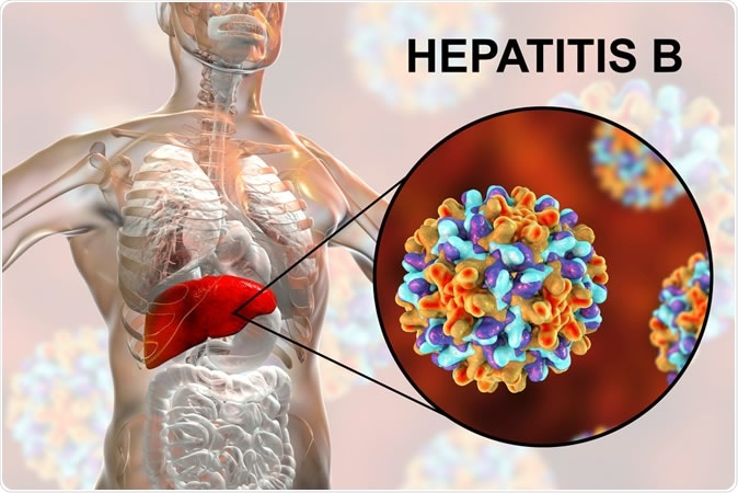 Liver with Hepatitis B infection highlighted inside human body and close-up view of Hepatitis B Viruses. 3D illustration - Illustration Credit: Kateryna Kon / Shutterstock