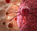New protein target for deadly ovarian cancer
