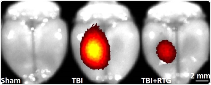 Red and yellow areas show sites of cell death in the mouse brain. The brain at left has no traumatic brain injury (TBI). The brain at center is post-TBI. The brain at right is post-TBI and treated with the novel therapy; cell death is nearly abolished. Image Credit: Mark S. Shapiro, Ph.D., UT Health San Antonio