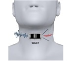Wearable artificial throat may one day help mute people 'speak'