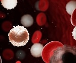 Capturing Circulating Leukemia Cells for Analysis by Flow Cytometry