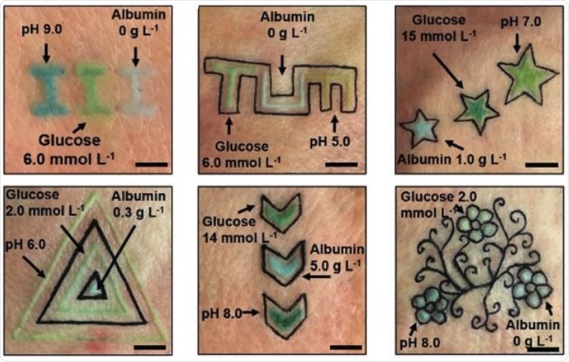 Glucose-sensing tattoos