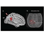 Deep brain stimulation impairs memory recall