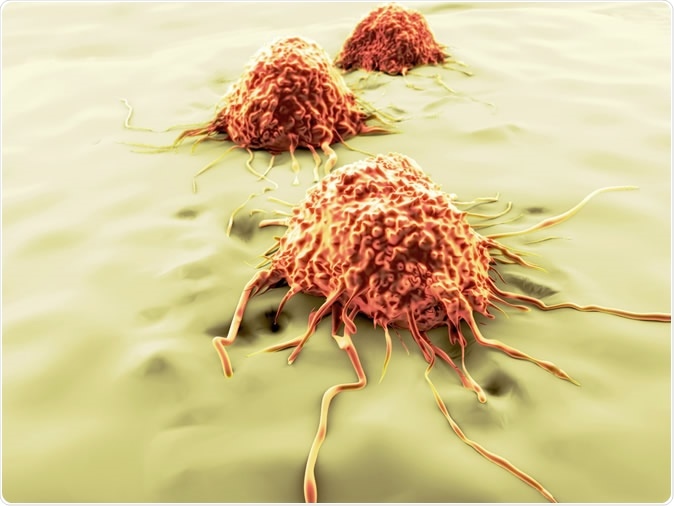 Migrating cancer cells. Image Credit: Juan Gaertner / Shutterstock