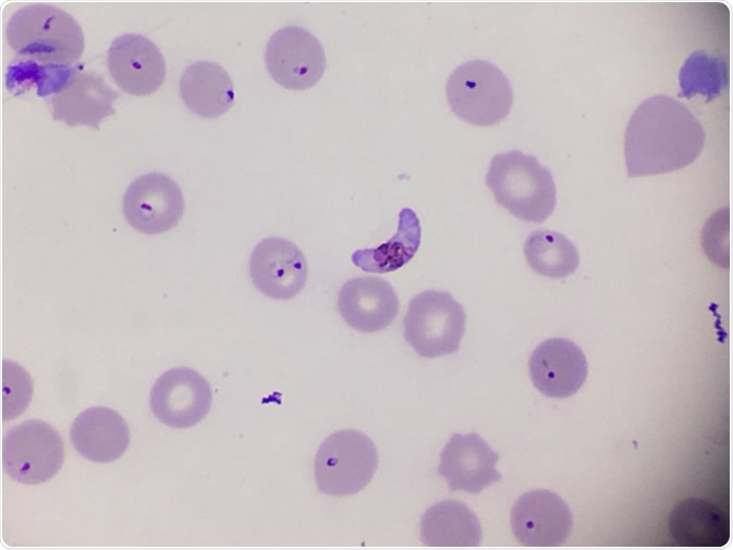 Plasmodium falciparum gametocyte in blood smear. Image Credit: Pingpoy / Shutterstock