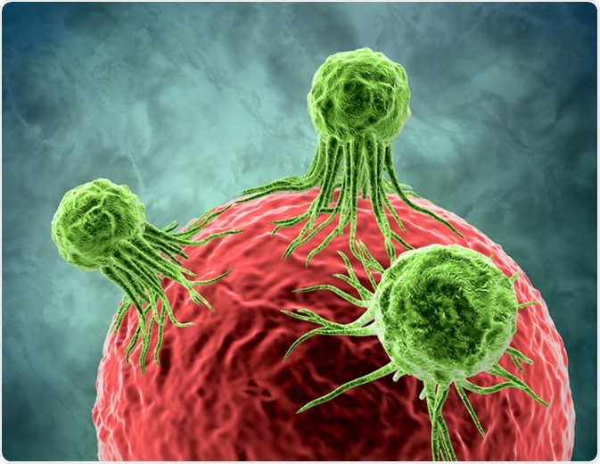 Tumor cancer cells attacking and growing on human cell 3d rendering. - Illustration Credit: Illustration Forest / Shutterstock