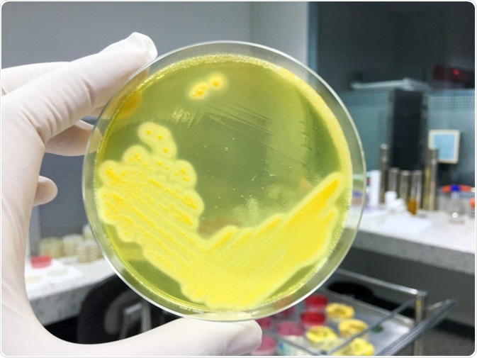Staphylococcus aureus grow on Mannitol salt agar. Image Credit: Pattikky / Shutterstock