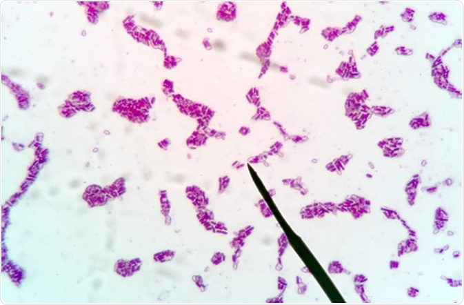 Clostridium botulinum gram stain. Image Credit: Patiyurh Sirisukpokar