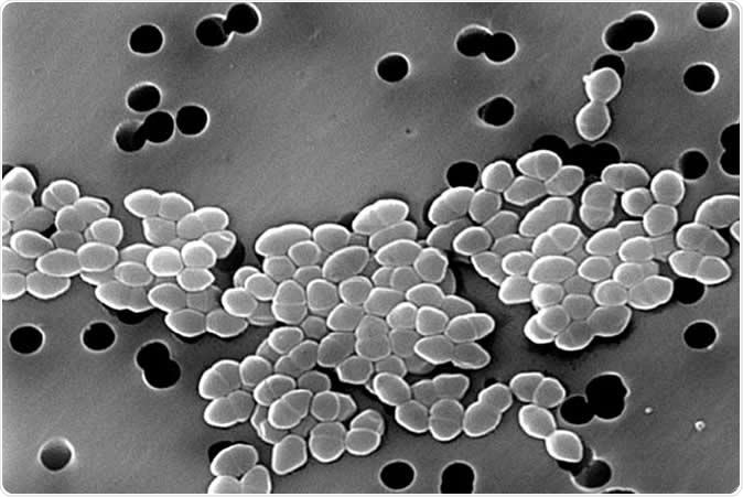 Vancomycin-resistant Enterococci, as imaged with a scanning electron microscope. (Photo by Janice Haney Carr/CDC)