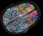 Brain maps show activity related to meaning and not mode of learning