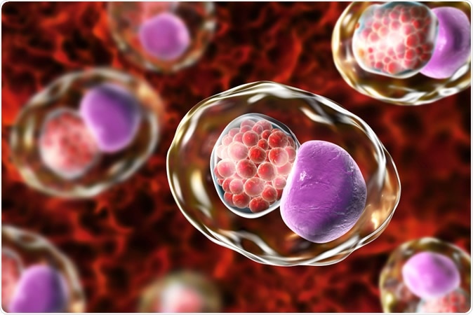 Chlamydia trachomatis bacteria, 3D illustration showing reticulate bodies of Chlamydia forming intracellular intracytoplasmic inclusions (small red) near the cell nucleus (purple) - Illustration Credit: Kateryna Kon / Shutterstock