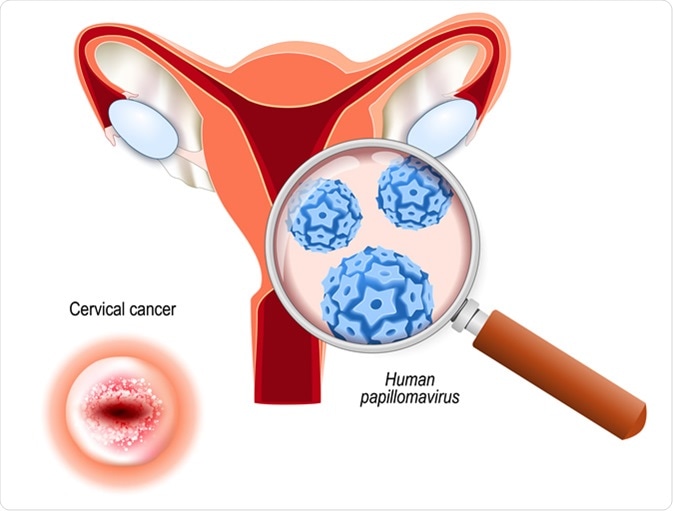 hpv and blood cancer)