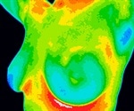 Thermography versus Mammography: Which is Best?