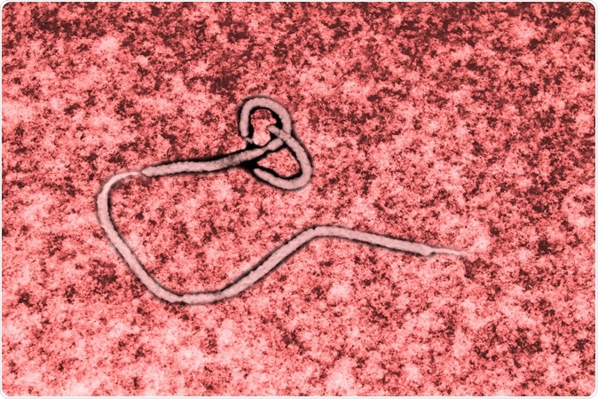Ebola virus seen under a microscope. Image Credit: Studio_3321 / ShHutterstock