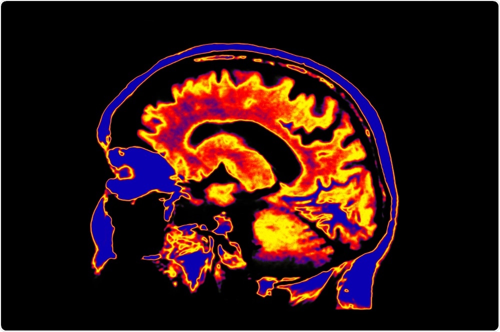 MRI of brain - imagination, abstract