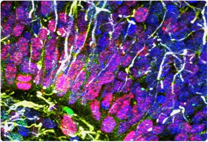 UC San Diego Stem Cell Program found complex network signaling developing in human cortical organoids that appear to recapitulate fetal brain development, offering an in-vitro model to study functional development of human neuronal networks. https://www.youtube.com/watch?v=rkpo7R8UOlc