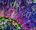 “Mini Brains” in the lab show electrical activity similar to a preemie’s brain