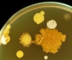 Researchers identify compounds that tackle fungal infections in a new way