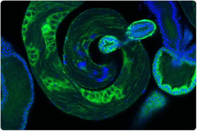 Developing sperm, in blue, within a fruit fly testis. IMAGE CREDIT Laboratory of Evolutionary Genetics and Genomics at The Rockefeller University