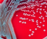 E. coli bacteria linked to Crohn's disease