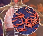 Tuberculosis still looms large over a fourth of the world’s people