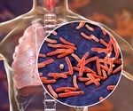 FDA approves effective new treatment for extremely drug-resistant tuberculosis