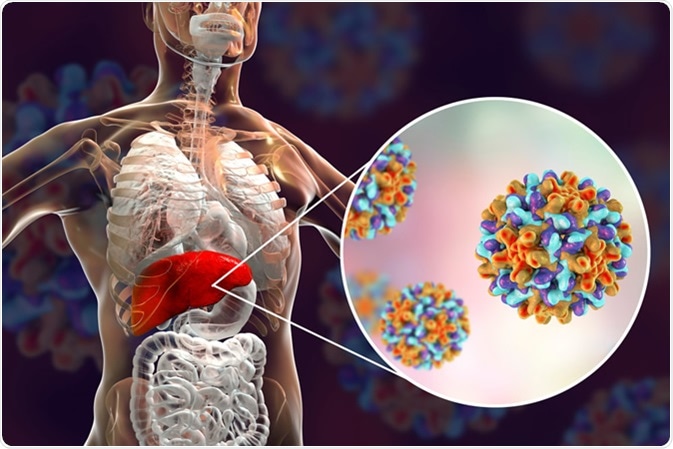 Liver with Hepatitis B infection highlighted inside human body and close-up view of Hepatitis B Viruses. Illustration Credit: Kateryna Kon / Shutterstock