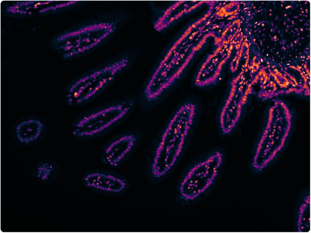 Fluorescent image showing intestinal stem cells