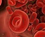 Blood clotting proteins in urine act as potent biomarkers for lupus