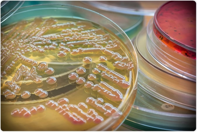 Bacteria colonies culture on MacConkey agar media (Klebsiella pneumoniae) contains small light grains.  Image Credit: Sirirat / Shutterstock