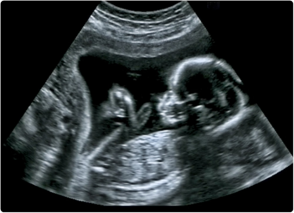 Fetus in the womb