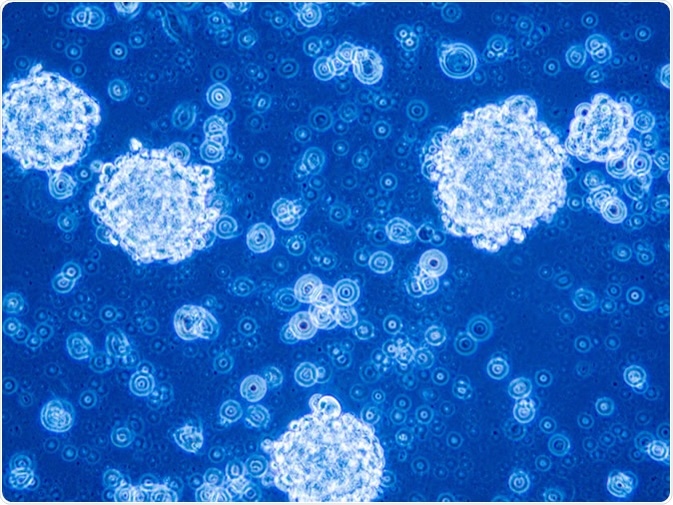 Glioblastoma stem cells organized in tumor niche formation. Image Credit: Anna Durinikova / Shutterstock