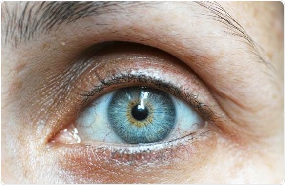 Research examines role of Nicotinamide in preventing retinal cell damage caused by glaucoma