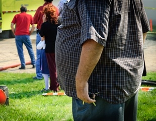 Obesity linked to poorer outcomes in people with bipolar disorders