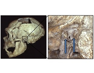 'Swimmer’s ear' found to be common among Neanderthals
