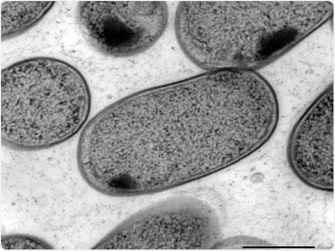 Transmission electron microscopy (TEM) of in vitro-cultured Klebsiella (Kp-2H7). Image Credit: Alessia Ranciaro