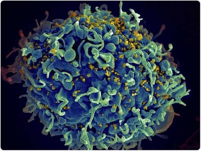 HIV infecting a human cell. Image Credit: NIH