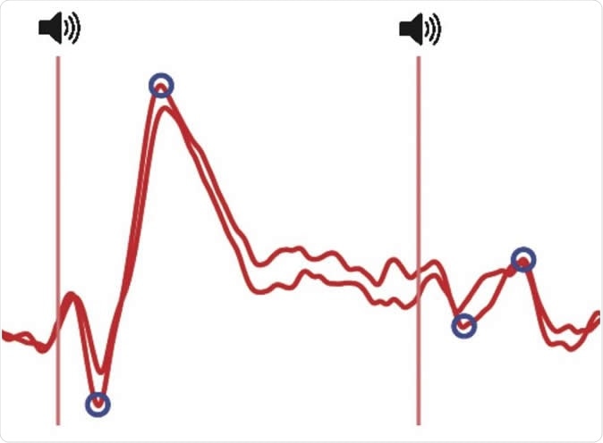 Decreased brain response to the same repeated sound at an interval of half a second (left is sound 1, right is sound 2). Illustration: the responses recorded above the auditory areas of the cortex by means of electroencephalographic electrodes.  CREDIT © UNIGE