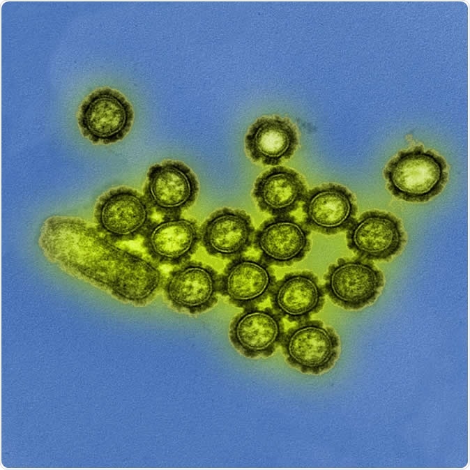This colorized transmission electron micrograph depicts H1N1 influenza virus particles. Image Credit: NIAID