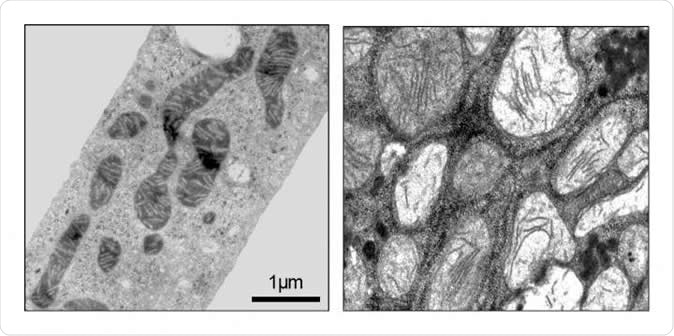 Mitochondria of liver cells by electronic microscopy. On the left, normal mice: mitochondria present an elongated shape. On the right, mice without the OPA1 protein: mitochondria present an altered globular form. Image Credit: UNIGE