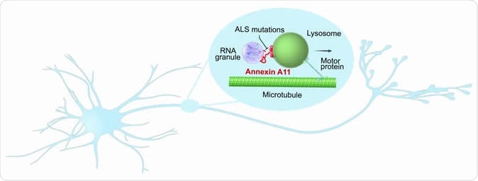 Researchers discovered that annexin A11, a gene linked to a rare form of ALS, may play a critical role in the transport of important, RNA encoded housekeeping instructions throughout neurons. Their results suggest that the gene does this by hitching RNA granules onto traveling lysosomes and that disease-causing mutations prevent hitchhiking. Image Credit: NIH/NINDS