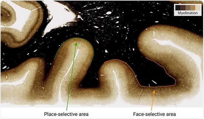 Higher myelination (darker stain) is found in the face-selective area of higher visual cortex, as compared to place selective area. Image Credit: MPI CBS