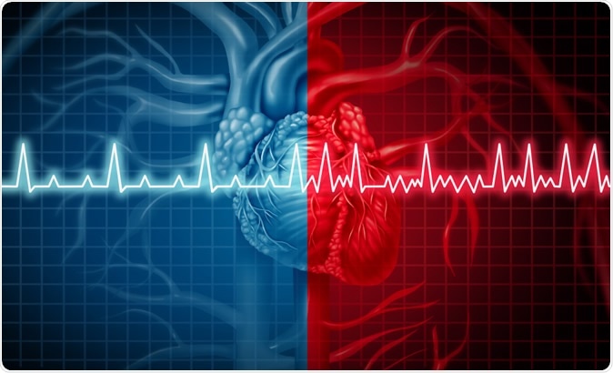 Atrial fibrillation and normal or abnormal heart rate rythm. Image Credit: Lightspring / Shutterstock