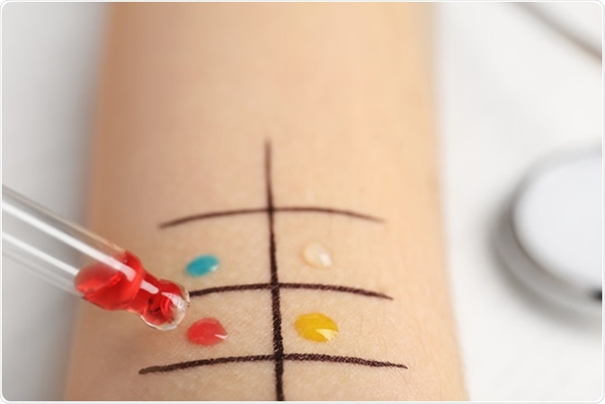 Allergy test on wrist - Image Credit: New Africa / Shutterstock