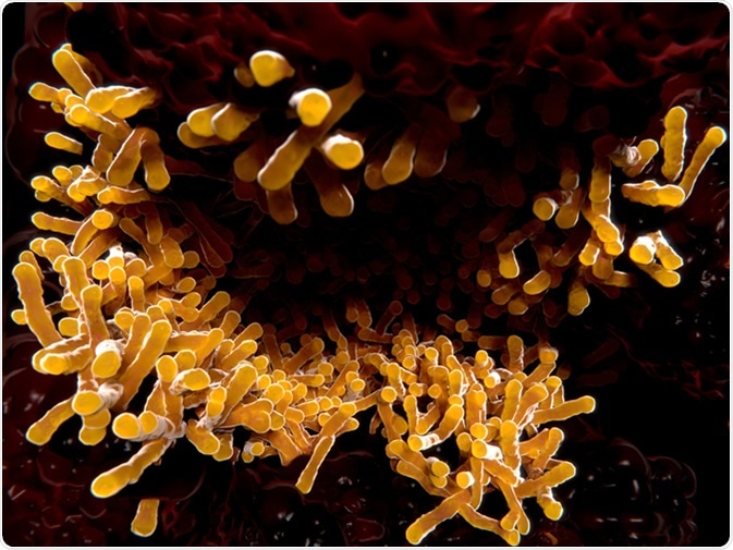 Tuberculosis bacillus in the lungs. Tuberculosis is caused by the bacterium Mycobacterium tuberculosis. Image Credit: Juan Gaertner / Shutterstock