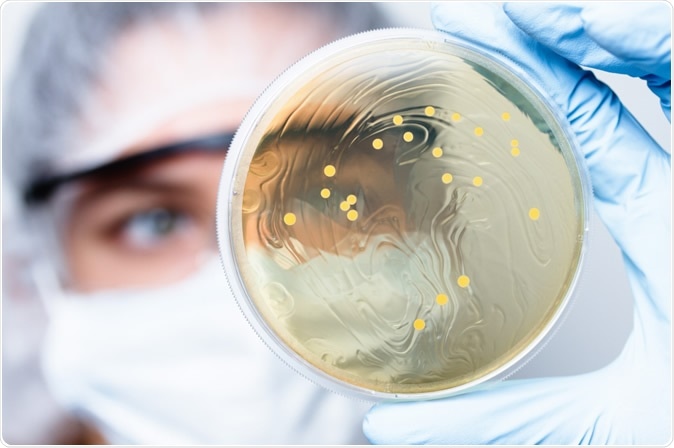 Lactobacillus bacteria colonies. Image Credit: INatalieIme / Shutterstock