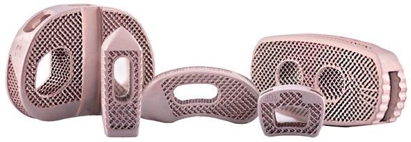DePuy Synthes introduces 3D-printed titanium interbody implants for spinal fusion surgery