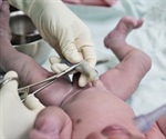 Delayed umbilical cord clamping is effective even when newborn is placed on mother's abdomen